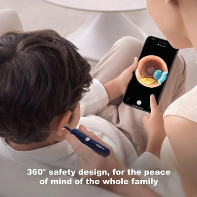 BEBIRD EarSight Plus I35R
